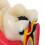 De De Cárie Dentária Com Dentes E Ferramentas Bilaterais 9