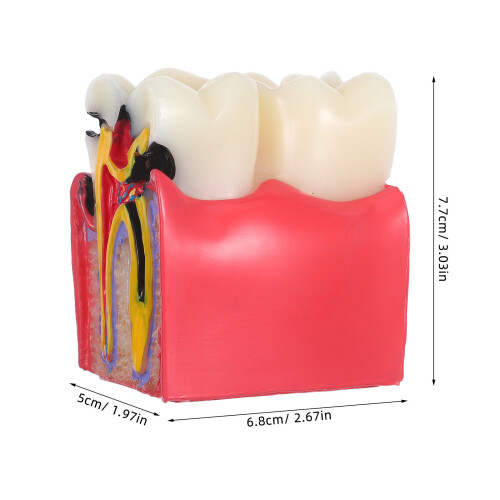 De De Cárie Dentária Com Dentes E Ferramentas Bilaterais 2