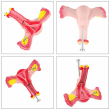 1:1 Uter feminin uter ovar trompele uterine model anatomic instrumente didactice