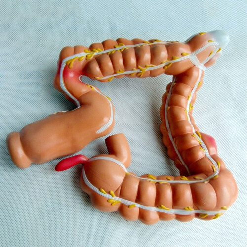 Teaching Model,Human Large Intestine Anatomy Model Visceral Lesion Human Digestive System Learning 1