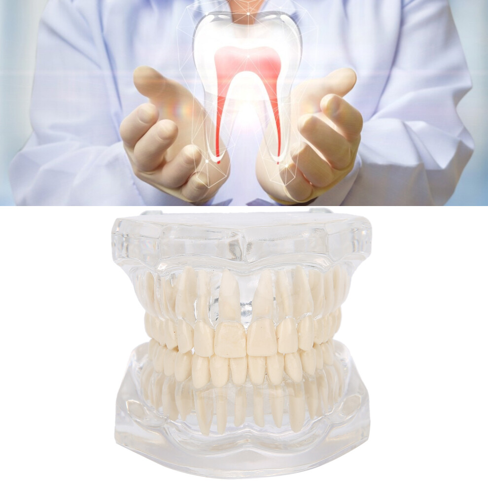 Transparent Acrylic Dental Teeth Model for Teaching Demonstration and Study