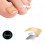 (72) Glue-free Ingrown Nail Paste Ingrown Nail Corrector Tool High Quality 4