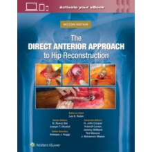 The Direct Anterior Approach to Hip Reconstruction by Joseph T. Moskal