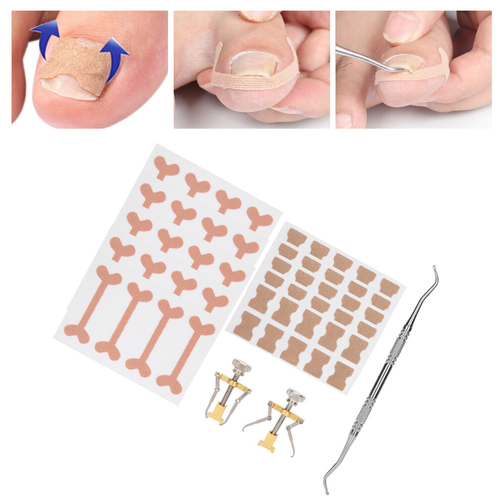 White Ingrown Toenail Fixer 13Pcs Pedicure Tools Orthotic Correction Patch Set