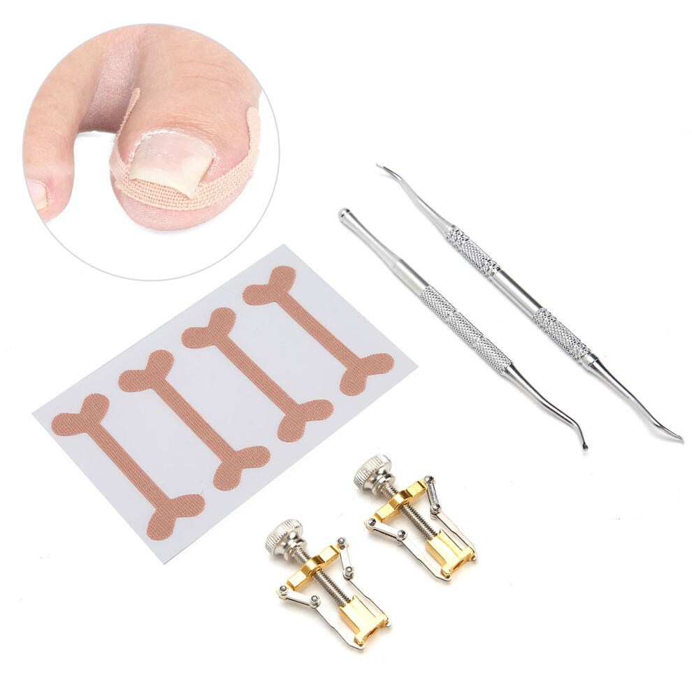 5pcs Pedicure Tools Set for Ingrown Toenail Correction, Care