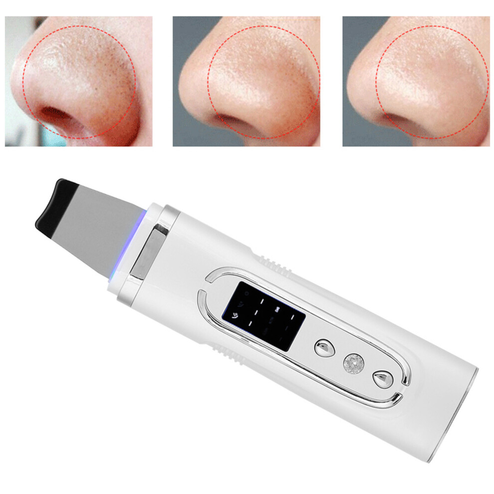 White Household Ultrasonic Skin Scrubber Blackhead Remover Ems Face Pore Cleaner