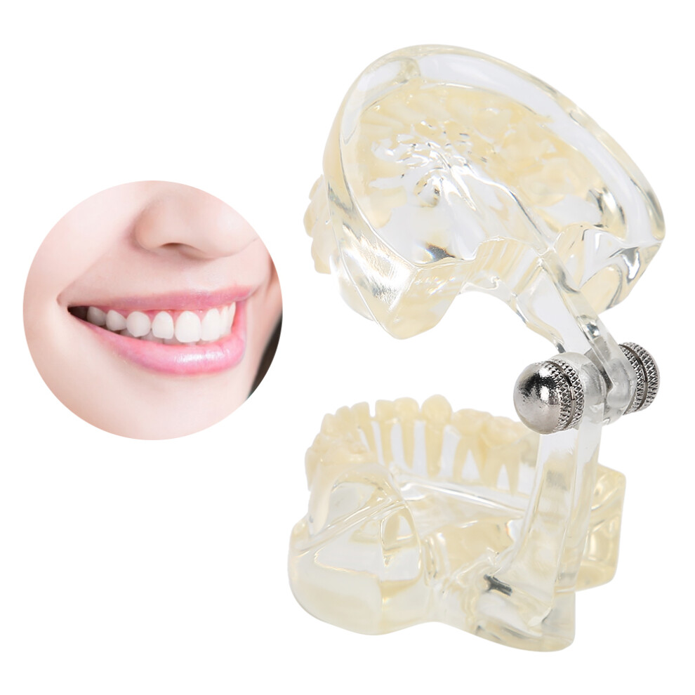 Removable Deciduous Teeth Model for Children, 6.2cm Height, Transparent