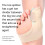 Silicone Bunion Corrector Toe Straightener & Separator Adjustable Fit 5