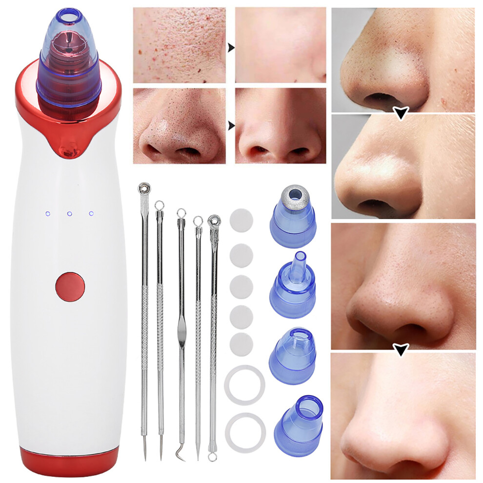 Adjustable Electric Acne Remover: Gentle Exfoliation & Pore Cleaning