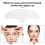 Compact Anti-Wrinkle Forehead Patch - Medical Silicone Reusable & Effective 8