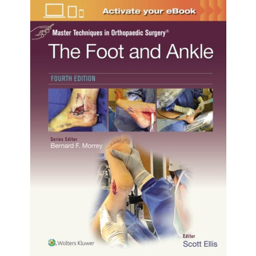 Master Techniques in Orthopaedic Surgery The Foot and Ankle Print book