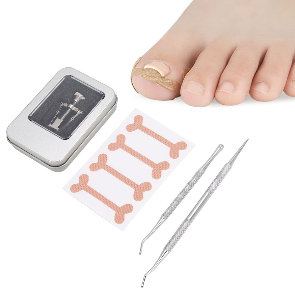 Silver Ingrown Toenail Correction Kit Alloy Stainless Steel Tools
