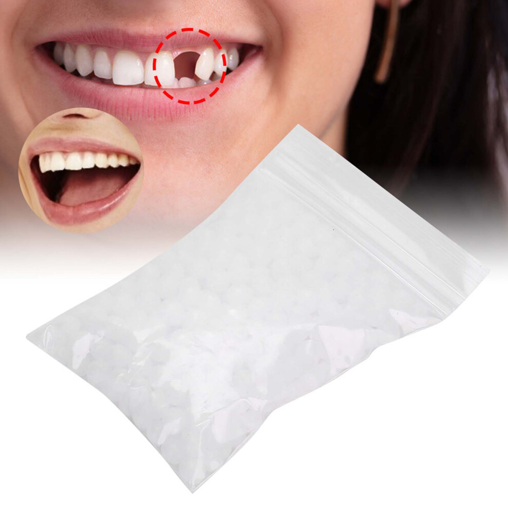 Temporary Tooth Repair Beads Kit, 50g, Food Grade Plastic, Dental Filling Material