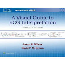 A Visual Guide to ECG Interpretation Print book with Multimedia by DAV