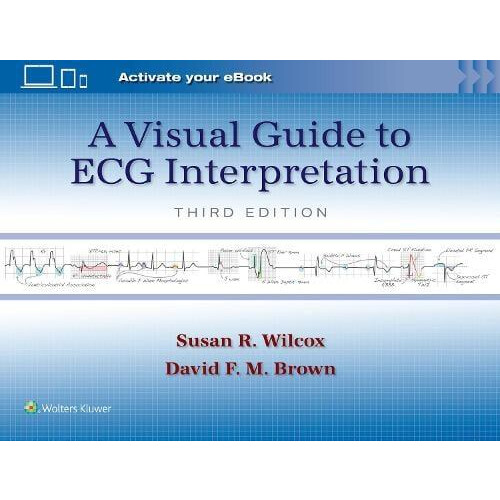 A Visual Guide to ECG Interpretation Print book with Multimedia by DAV