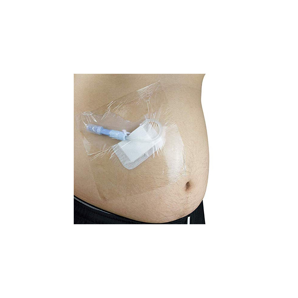 Disposable Shower Shield for Peritoneal Dialysis, Waterproof Catheter Barrier, Essential Care for Dialysis Patients