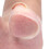 2PCS Ingrown Toenail Correction Sleeves, Thick Silicone Toe Cap 12