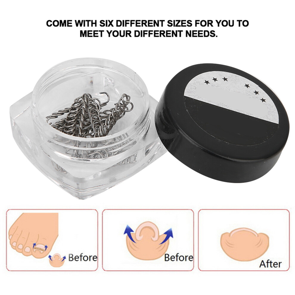 2Box Toenail Correction Wire Pedicure Tool for Ingrown Nail Relief