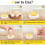 Retractable Pin Egg Piercer, Durable ABS Material, Stainless Steel Needle for Consistent Egg Shell Removal 5