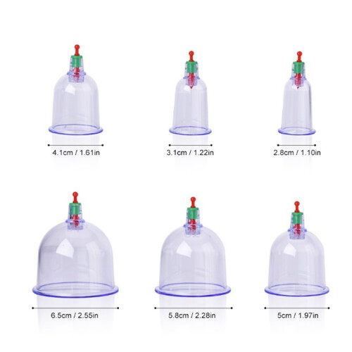 12 Pcs Transparent Chinese Cupping Therapy Set | Multi-Size, Eco-Friendly 1