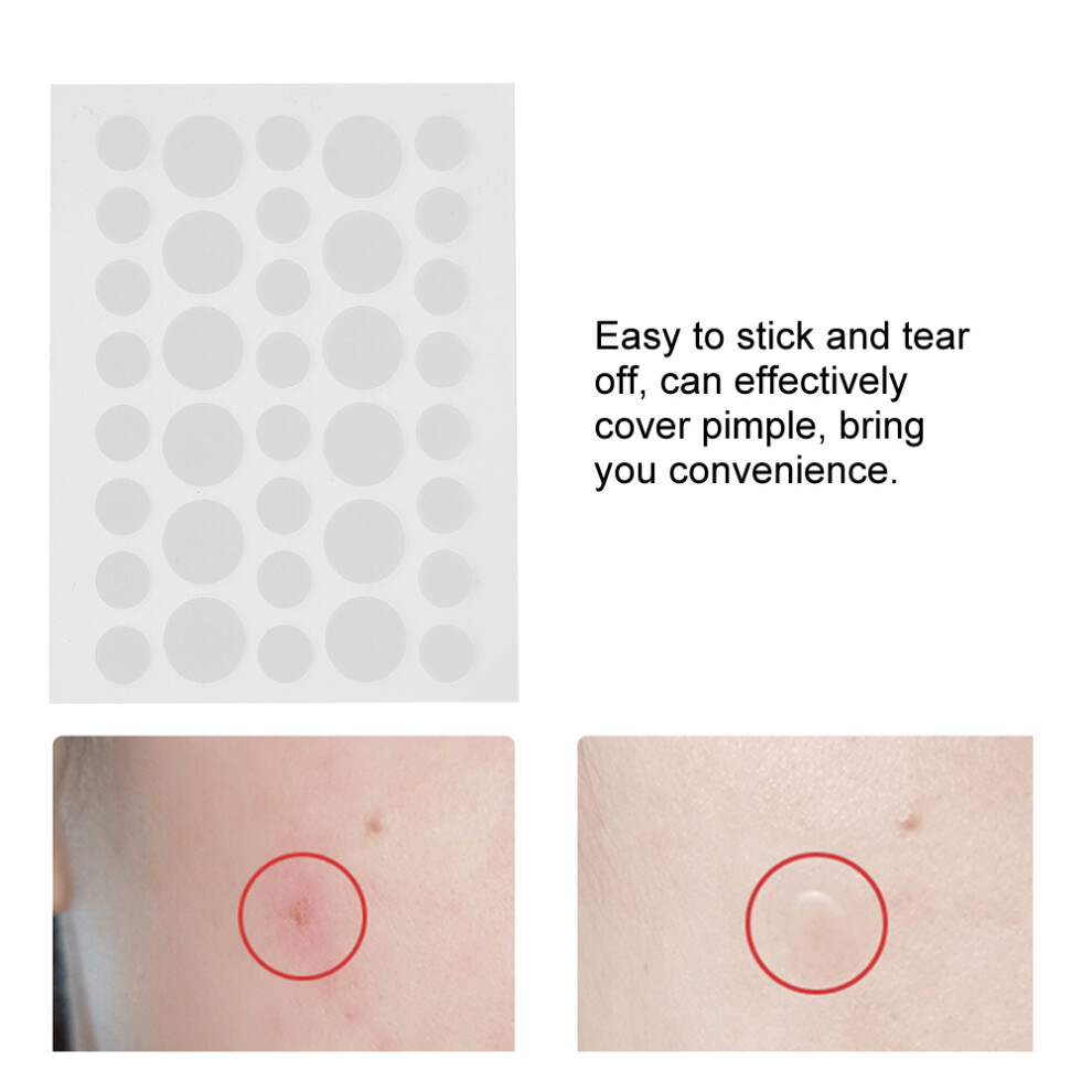 Hydrocolloid Acne Pimple Patches 36 Sheets Transparent Cover & Concealing