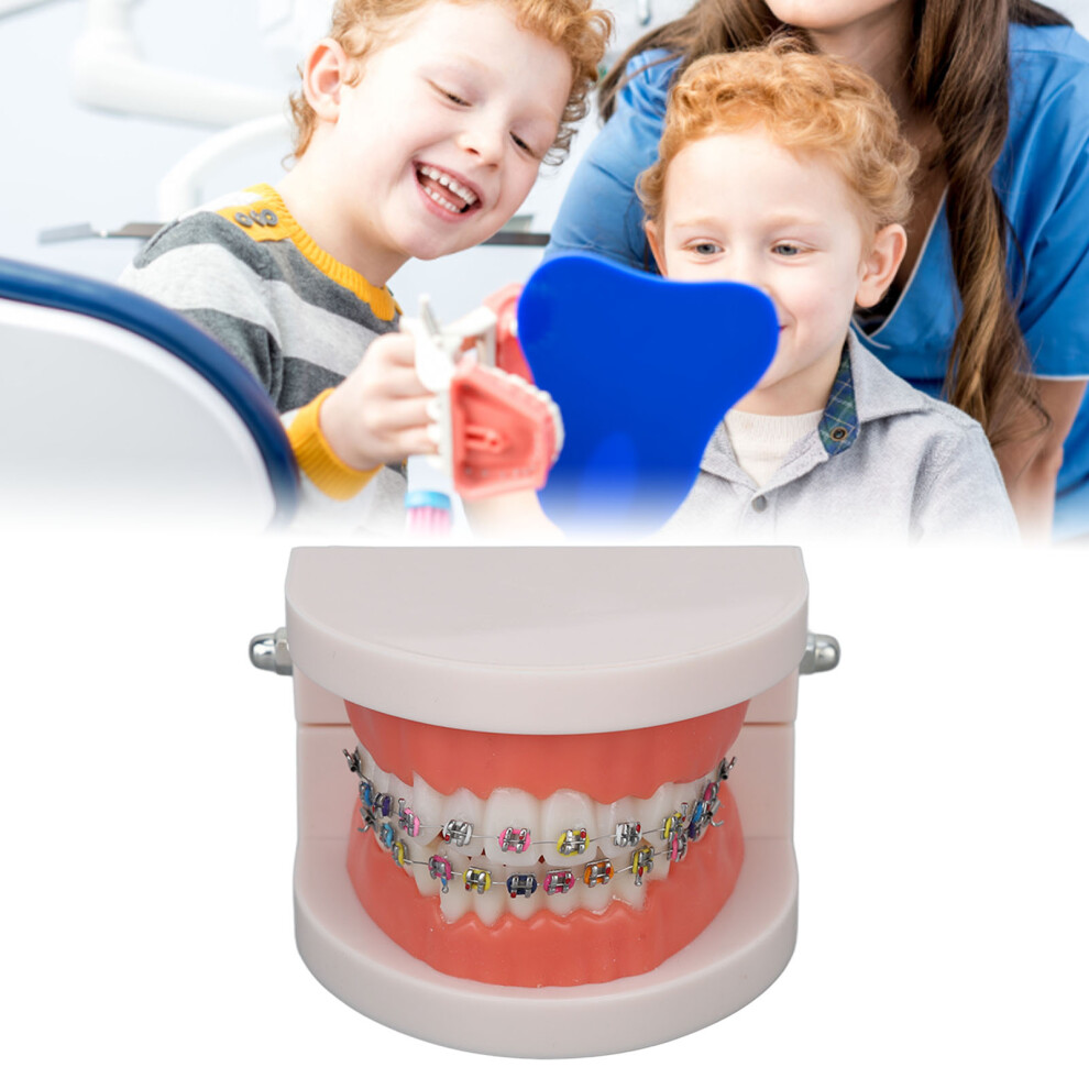 Teeth Model with Orthodontic Metal Brackets for Dental Education and Research