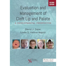 Evaluation and Management of Cleft Lip and Palate by Linda D. VallinoN