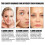 Στυλό μικροβελόνας Dermastamp Drs 140 από ανοξείδωτο ατσάλι, ρυθμιζόμενες βελόνες Derma 4