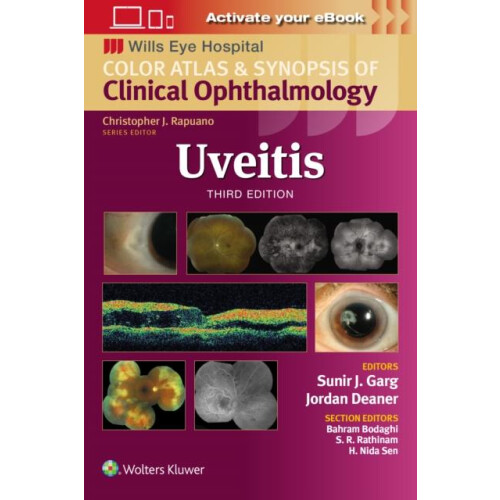 Uveitis by Sunir J. Garg Paperback Book