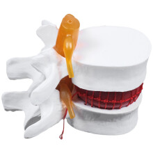 Anatomia Humana Esqueleto Coluna Vertebral Hérnia de Disco Lombar Modelo Didático Cérebro Crânio Material Escolar para Estudo de Trauma