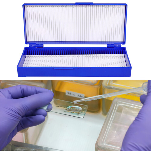 2 Pcs Food Storage Boxes With Lids Freezer Case Pathological 2
