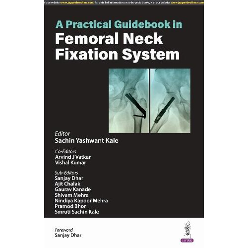 A Practical Guidebook in Femoral Neck Fixation System by Vishal Kumar