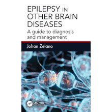 Epilepsy in Other Brain Diseases by Johan Zelano Paperback Book