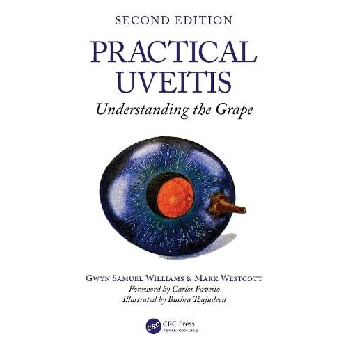 Practical Uveitis by Westcott Mark Moorfields Eye Hopsital 123 Old Str