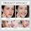 Facial Acne Patch Breathable 10
