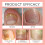 Nail Care Patches for Soft, Smooth & Shiny Nails 13
