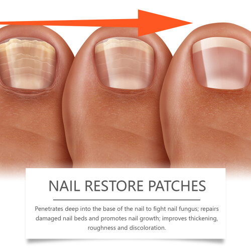 Nail Care Patches: Gentle Moisturizing & Protective 2