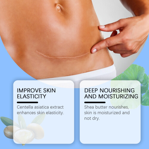 Moisturizing Skin Care Gel 2