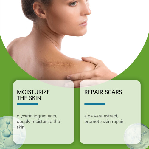 Silicone Gel Body Patches - Soft, Breathable, Cuttable 2