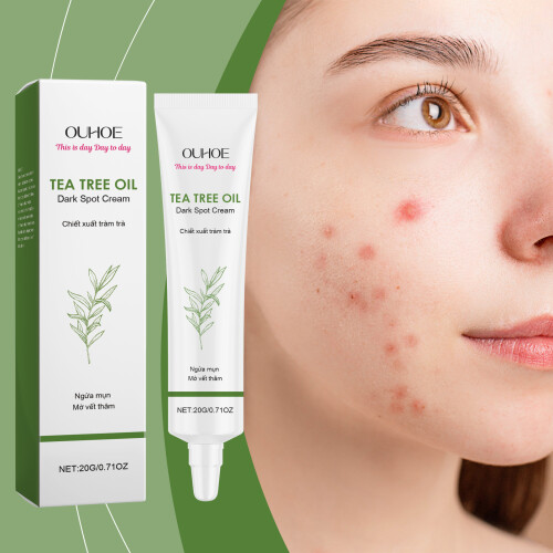 Facial Care Cream for Acne & Moisturizing 1