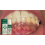 Press-Type Teeth Mousse for Fresh Breath & Deep Oral Cleaning 7