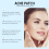 Portable Acne Patch: Cleansing & Skin Care 10