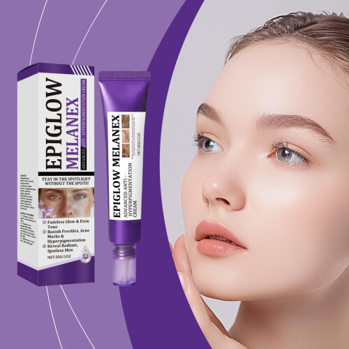 Retinol-Antifleck-Creme für strahlende Haut 1