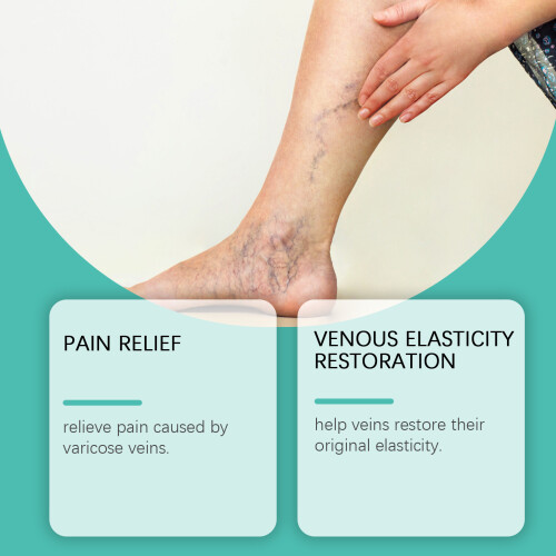 Leg Care Patches, Moisturizing, Soothing, Improving Bulging Veins 2