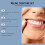 Denture Modification Sets: Narrow Gaps, Enhance Smiles, Comfort Care 10