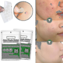 (2 x 24Pcs-3 Size) Acne Pimple Patch,invisible Hydrocolloid Acne Patch For Blemishes And Zits Cover, Spot Stickers For Face And Body