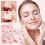 (2 Boxes) Blackhead Remover Mask Blackhead Ances improving Cleaner Mask for Face Nose 2