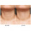 (neck)Wrinkle Remover Strips Reusable Silicone AntiWrinkle Chest Pads 2