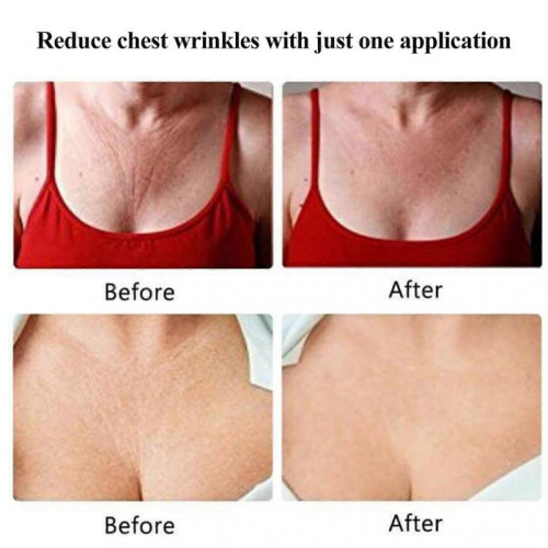 (chest) Wrinkle Remover Strips Reusable Silicone AntiWrinkle Chest Pads 2