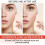 Pimple Patch  Hydrocolloid Plaster for Absorbing Acne Pimples 144Pcs Hydrocolloid Pimple Patch 1